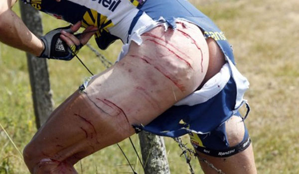 Might sound daft/dangerous - bike rack on a DB9?! - Page 1 - Aston Martin - PistonHeads - The image shows an intensely close-up view of a person's lower back and thigh area, with visible scratches and what appears to be a cut below their hip. The person is bent over, gripping a wire, suggesting they might be attempting to cut through it. Their attire consists of cycling clothes with a predominantly blue color. The person's buttocks are visible, along with a black accessory, possibly a knee brace or support, peeking from their shorts. The style of the image lends itself to a candid, snap-shot quality and the focus is clearly on the subject's actions and physical condition revealed by their clothing.