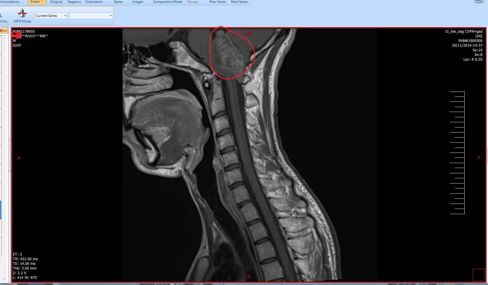 What's wrong with me?!  - Page 13 - Health Matters - PistonHeads