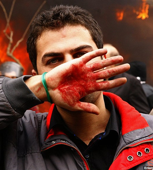 The image depicts a man standing amidst a fire, with visible distress. He has red paint or makeup smeared on his right cheek, and his left hand is raised to his nose, almost as if he's shielding his nose from the heat or smoke. The man's expression is serious and possibly in protest. The background suggests a chaotic or protest event, with more ambiguous figures barely visible in the distance. The man's attire seems casual, with a jacket and what looks like a wristband, indicative of a public demonstration or gathering. There is no text present in the image.