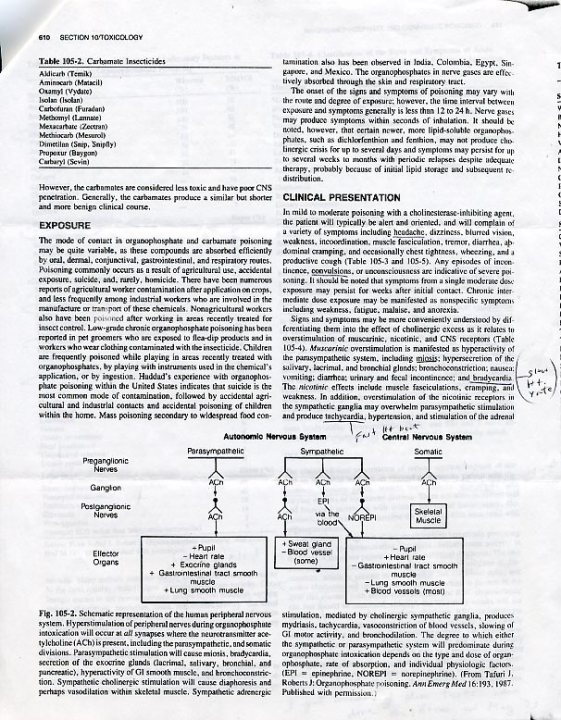 The image is of a document, specifically a page from a medical or scientific literature article. The title of the article, "Unintended consequences of gastric acid inhibition," is visible at the top, along with authorship information. The page contains the following sections: "INTRODUCTION," "EXPOSURE," and "CLINICAL EXPRESSION," with a subheading under "CLINICAL EXPRESSION" labeled "Draff," suggesting it is still a draft or unfinished section. The document is written in English. The text is too small and blurry to read in detail, but one can discern columns of print with headings and references under "REFERENCES" at the bottom.